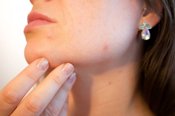 Pelle asfittica: cos'è e che prodotti utilizzare per una corretta skin care