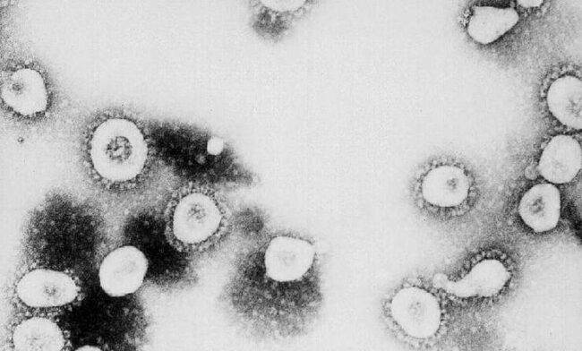 Coronavirus, nuovo Dpcm: cosa cambierà prossimamente nei prossimi giorni per gli italiani, nuove restrizioni in arrivo