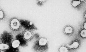 Coronavirus infettivologo