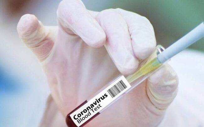 vaccino coronavirus quanto costa