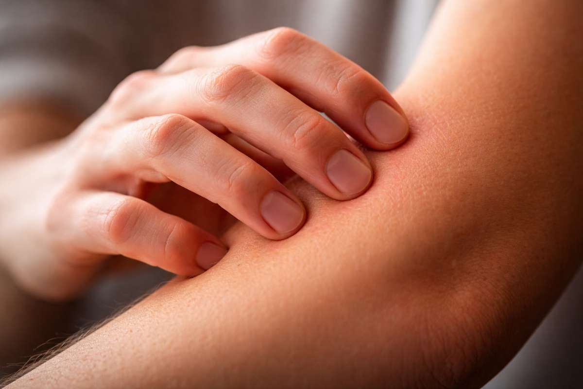 Scoperto il segreto del prurito